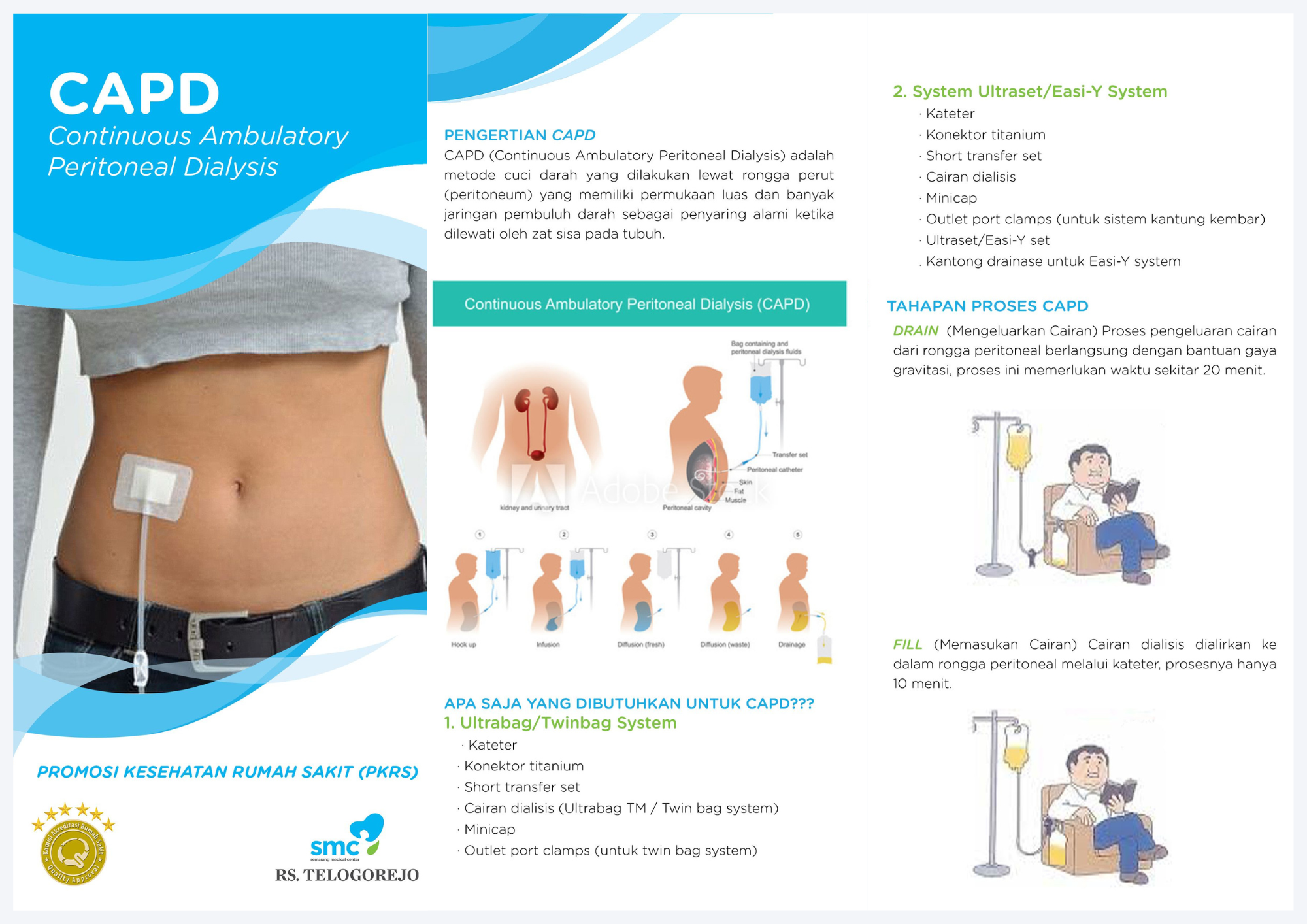 Perawatan peritoneal dialis (CAPD)