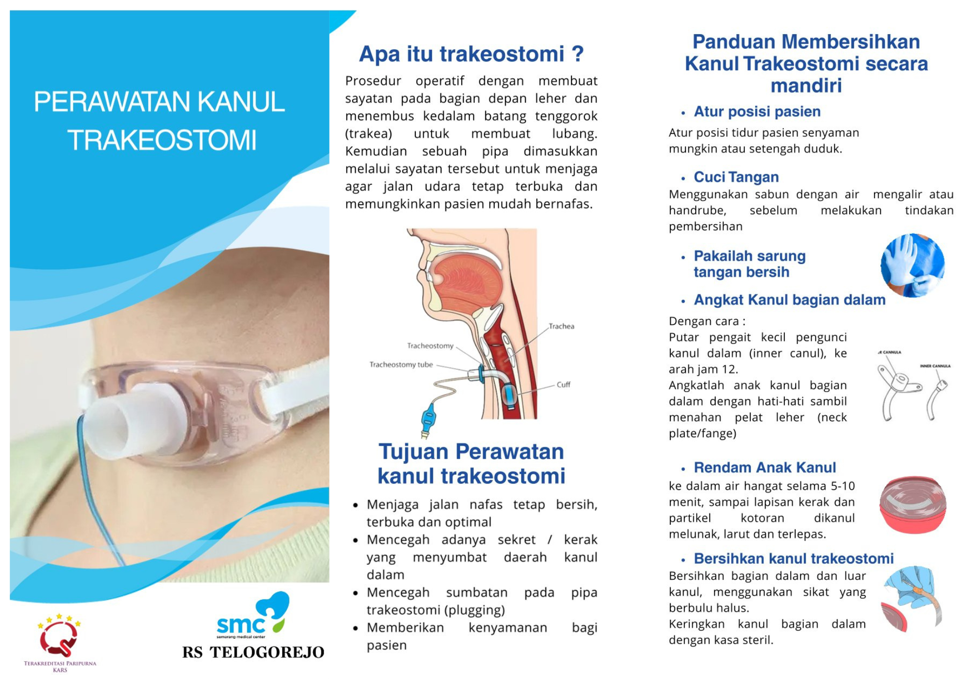 Perawatan Kanul Trakeostomi