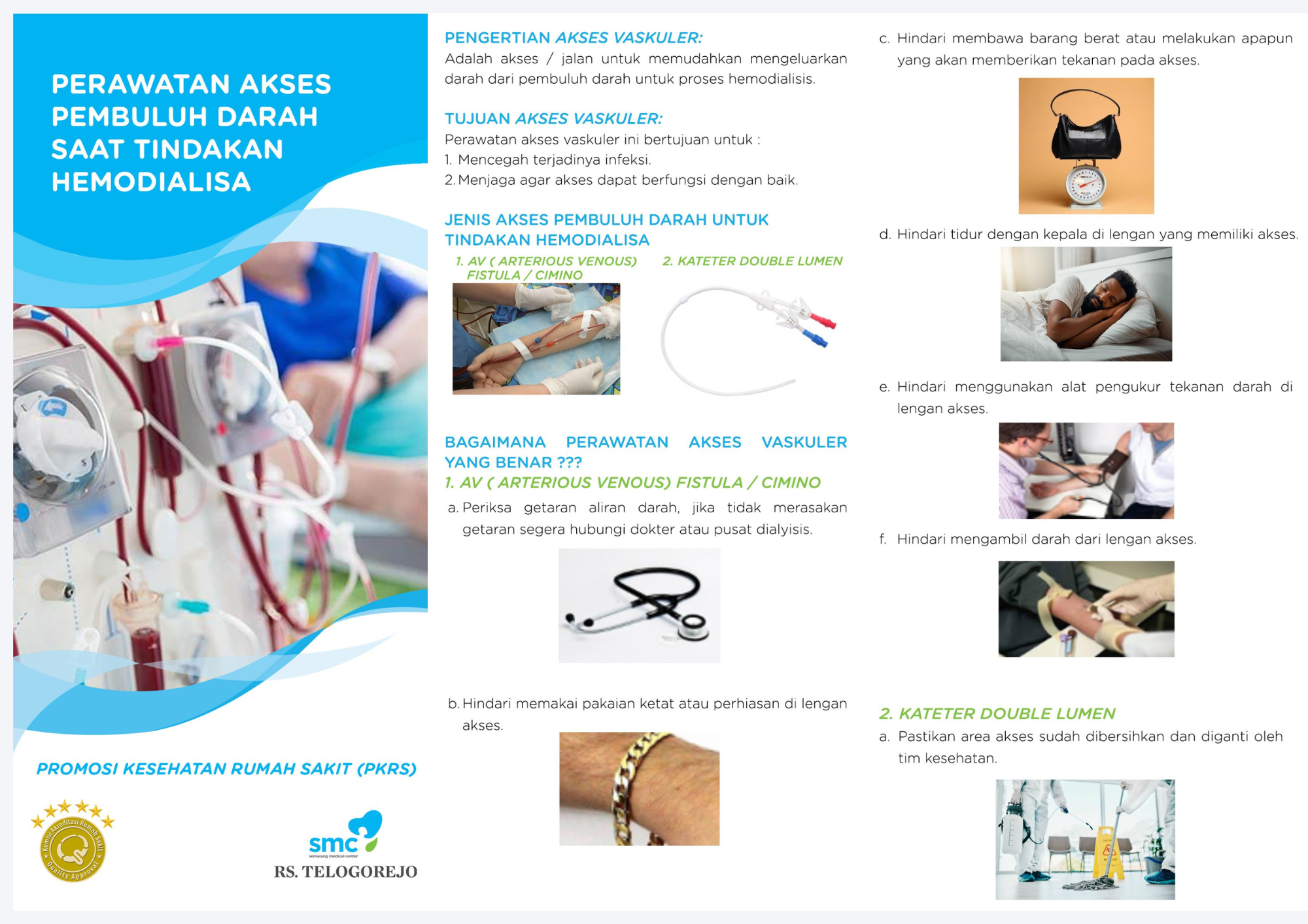 Perawatan AV Fistula / Cimino